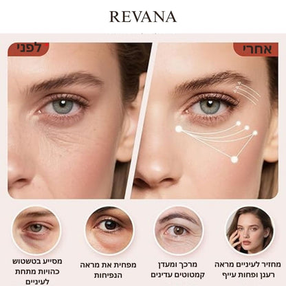 משקפי טיפול לעיניים -Revana Therapy